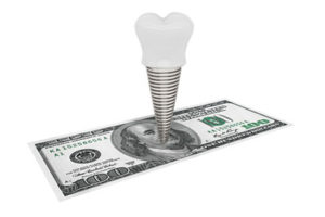 dental-implant-cost