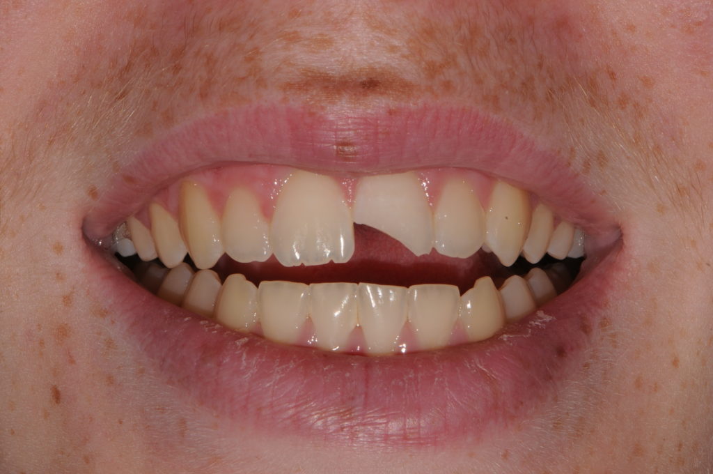 What to Do When Your Child is Injured in the Mouth