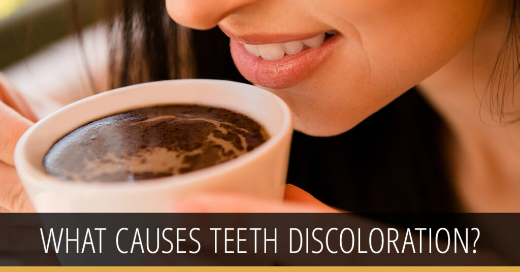 Teeth Whitening Houston Clear Lake ster TX