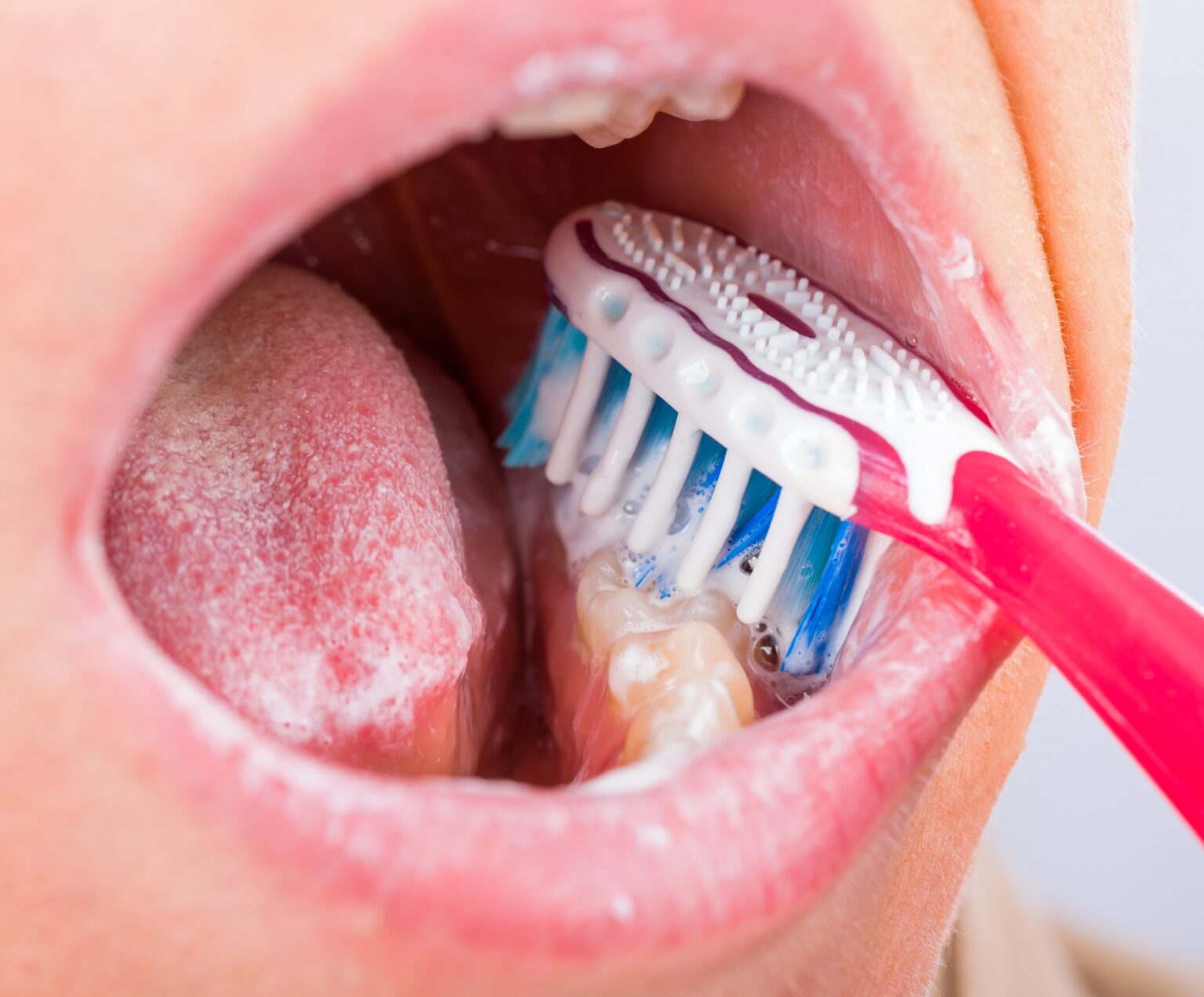 How to Get Rid of Plaque on Teeth