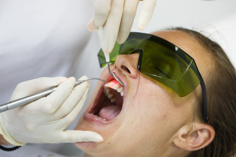 How Can Dental Lasers Improve my Oral Surgery Experience?
