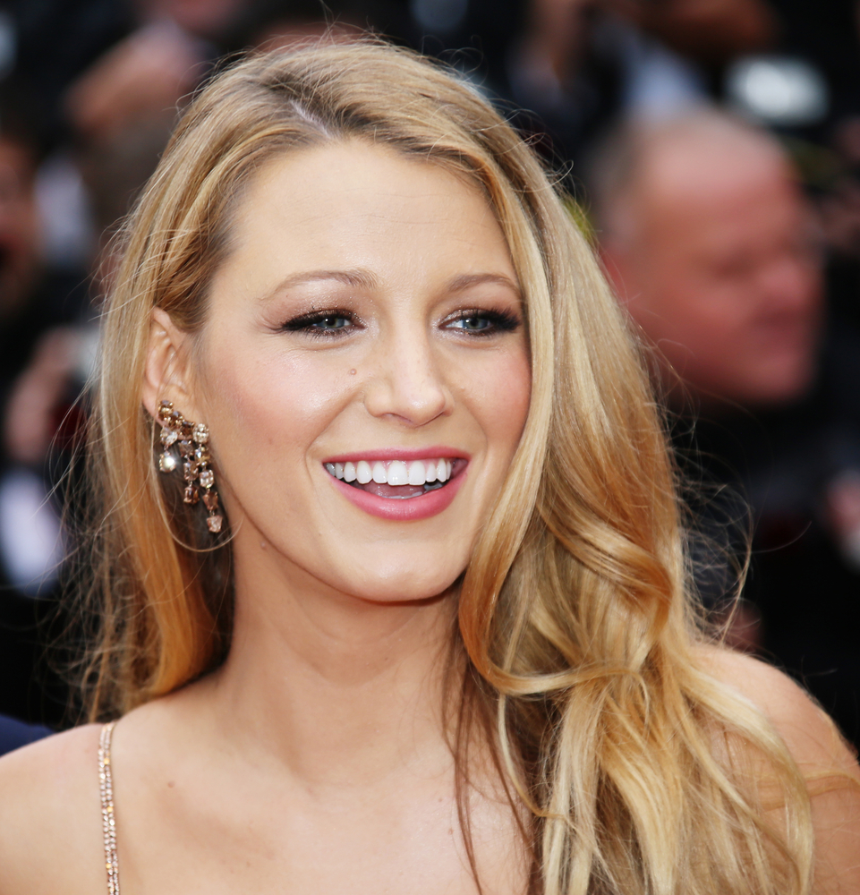 Can I Get a Celebrity Smile with Porcelain Veneers?