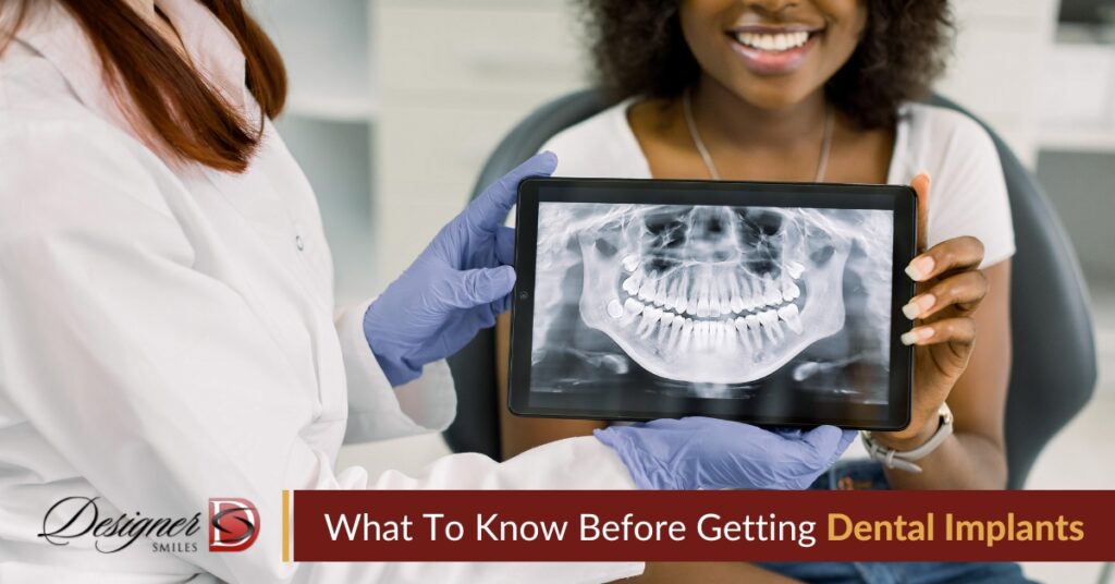 ster Dentist On Dental Implants